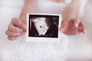 Read more about the article Scopri il Miracolo della Fecondazione In Vitro (FIV)