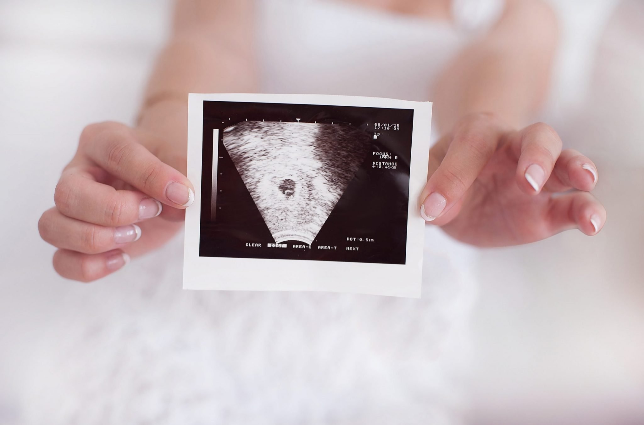 pregnancy